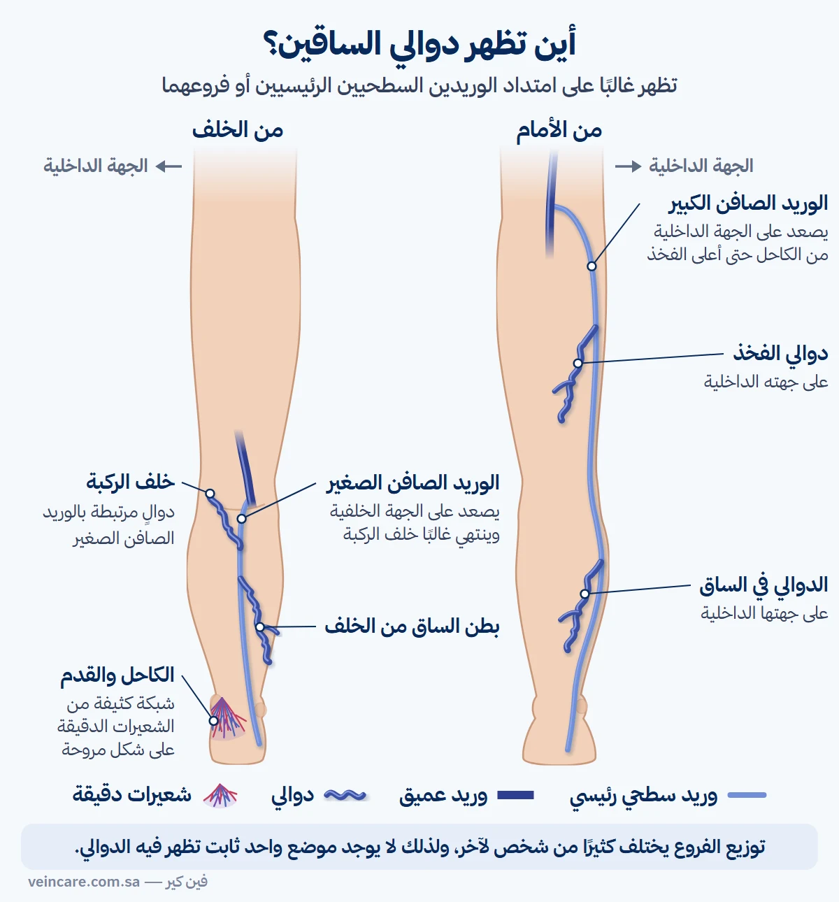 ساق يمنى من الأمام ومن الخلف: الوريد الصافن الكبير يصعد على الجهة الداخلية من الكاحل حتى أعلى الفخذ، والوريد الصافن الصغير يصعد على الجهة الخلفية من الساق وينتهي خلف الركبة، مع مواضع الدوالي على الجهة الداخلية من الفخذ والساق، وعلى بطن الساق من الخلف، وخلف الركبة، وشبكة شعيرات دقيقة على شكل مروحة عند الكاحل.